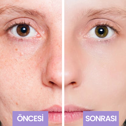 Evol Whitening Beyazlatıcı Krem Arbutin Leke Karşıtı