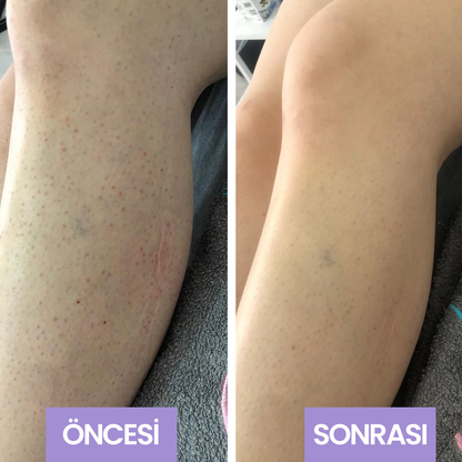 Evol Tuz Peeling Anında Batık Karşıtı El Vücut Peeling